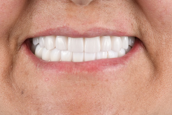 What Happens To Tooth Enamel With A Chipped Tooth?