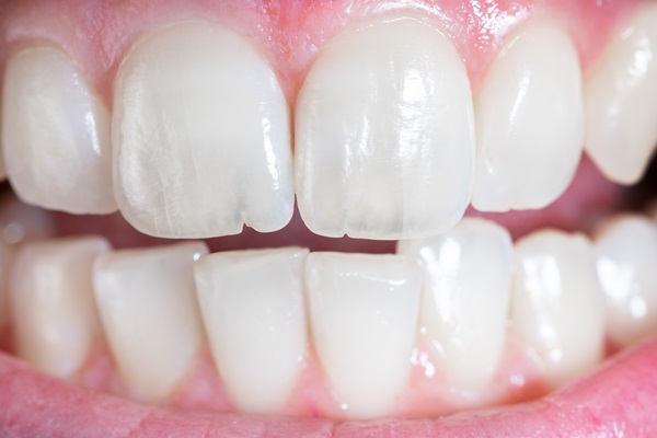 How An Endodontist Treats Cracked Teeth