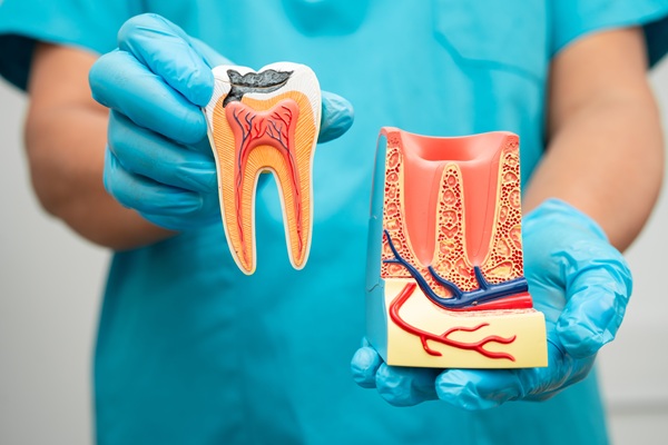 What Is Root Canal Retreatment?